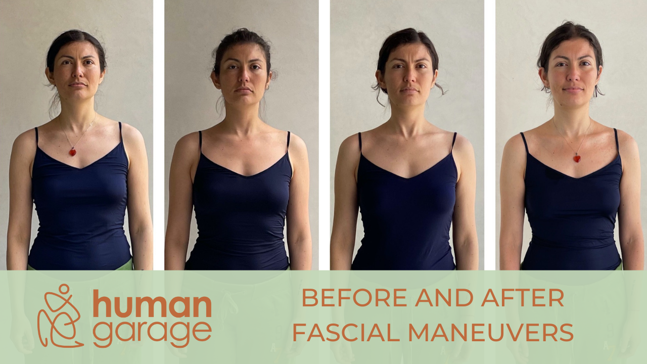 BEFORE AND AFTER FASCIAL MANEUERS: TWO YEARS LATER