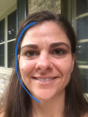 before and after pictures 