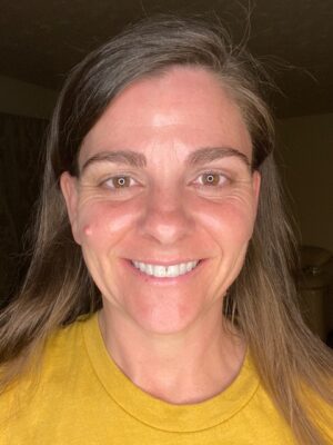 before and after pictures