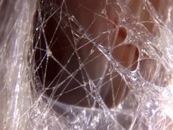 What are Fascial Maneuvers? cover